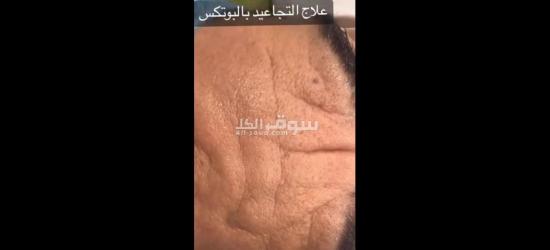 عيادة جلديه وتجميل وليزر للبيع من المالك مباشرة ب الأجهزة والرخصة..