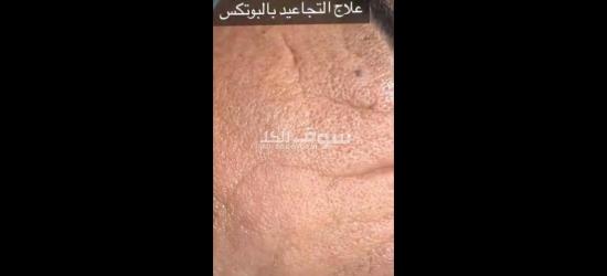 عيادة جلديه وتجميل وليزر للبيع من المالك مباشرة ب الأجهزة والرخصة.. - 2