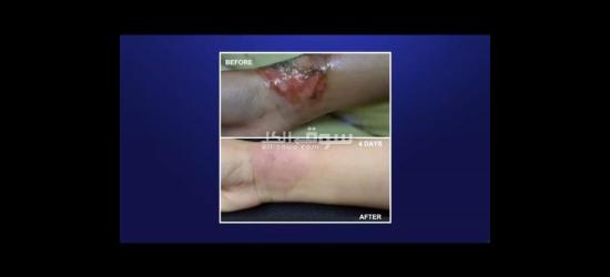 أقوى منتجات الصحيه والعنايه بالبشره وتعزيز الكولاجين فى الجسم والتخسيس بعروض خاصه - 5