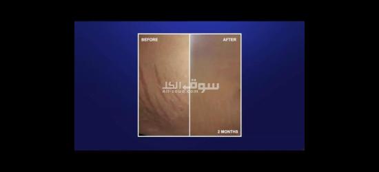 أقوى منتجات الصحيه والعنايه بالبشره وتعزيز الكولاجين فى الجسم والتخسيس بعروض خاصه - 6