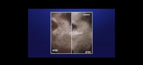 أقوى منتجات الصحيه والعنايه بالبشره وتعزيز الكولاجين فى الجسم والتخسيس بعروض خاصه - 7