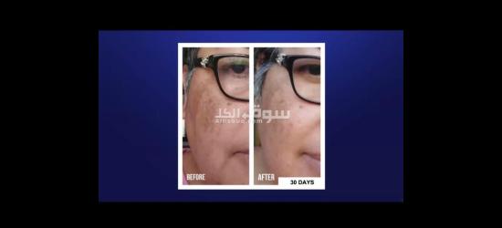 أقوى منتجات الصحيه والعنايه بالبشره وتعزيز الكولاجين فى الجسم والتخسيس بعروض خاصه - 9
