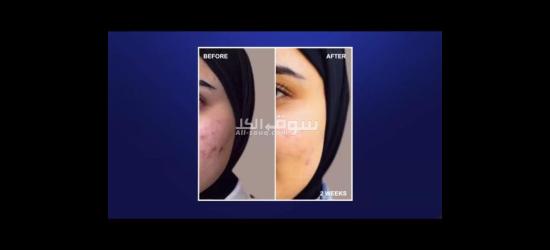 أقوى منتجات الصحيه والعنايه بالبشره وتعزيز الكولاجين فى الجسم والتخسيس بعروض خاصه - 10