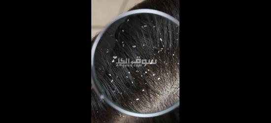 هيربال اسكراب - 6